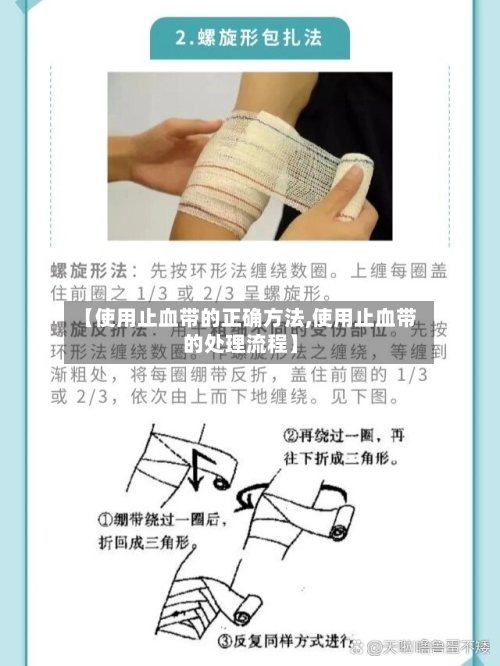 【使用止血带的正确方法,使用止血带的处理流程】
