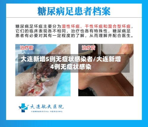 大连新增5例无症状感染者/大连新增4例无症状感染