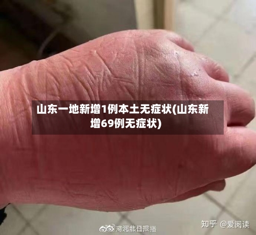 山东一地新增1例本土无症状(山东新增69例无症状)