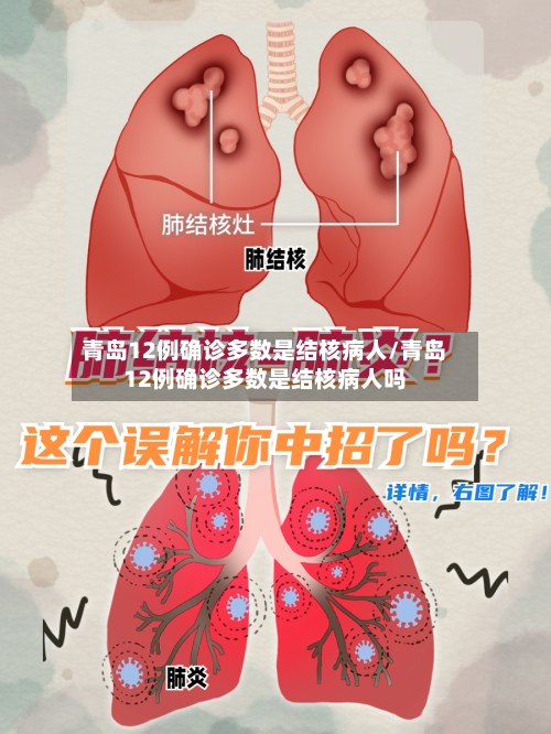青岛12例确诊多数是结核病人/青岛12例确诊多数是结核病人吗